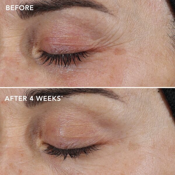 AGELESS+ Retinol Repair Crème 0.3% Retinol Complex - Image 5