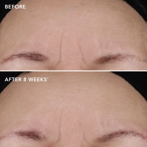 AGELESS+ Treatment Crème 1.2% Retinol Complex - Image 7