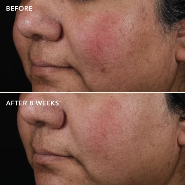 AGELESS+ Retinol Pure Liquid Retinol 0.75% - Image 3